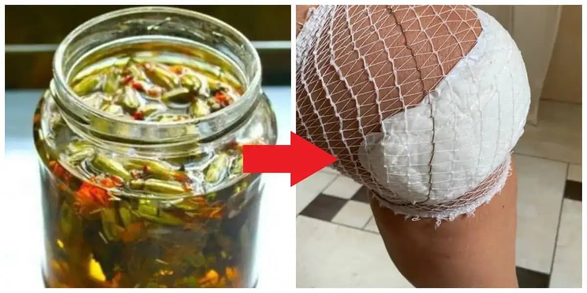 Toto by mal vedieť každý, koho bolia kolená: Najlepšie zábaly proti bolesti – toto vám pomohlo najviac a je to čistá príroda!