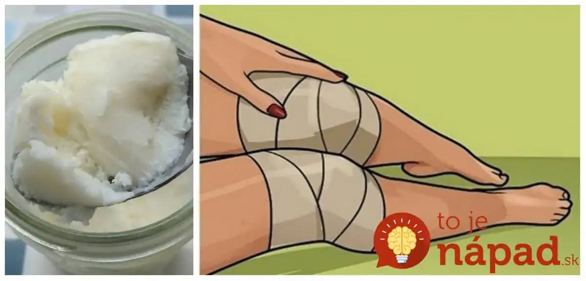 Tajomstvo našich dedov, ako zatočiť s bolesťou kolien bez liekov: Poraďte to každému, komu bolesť strpčuje život!