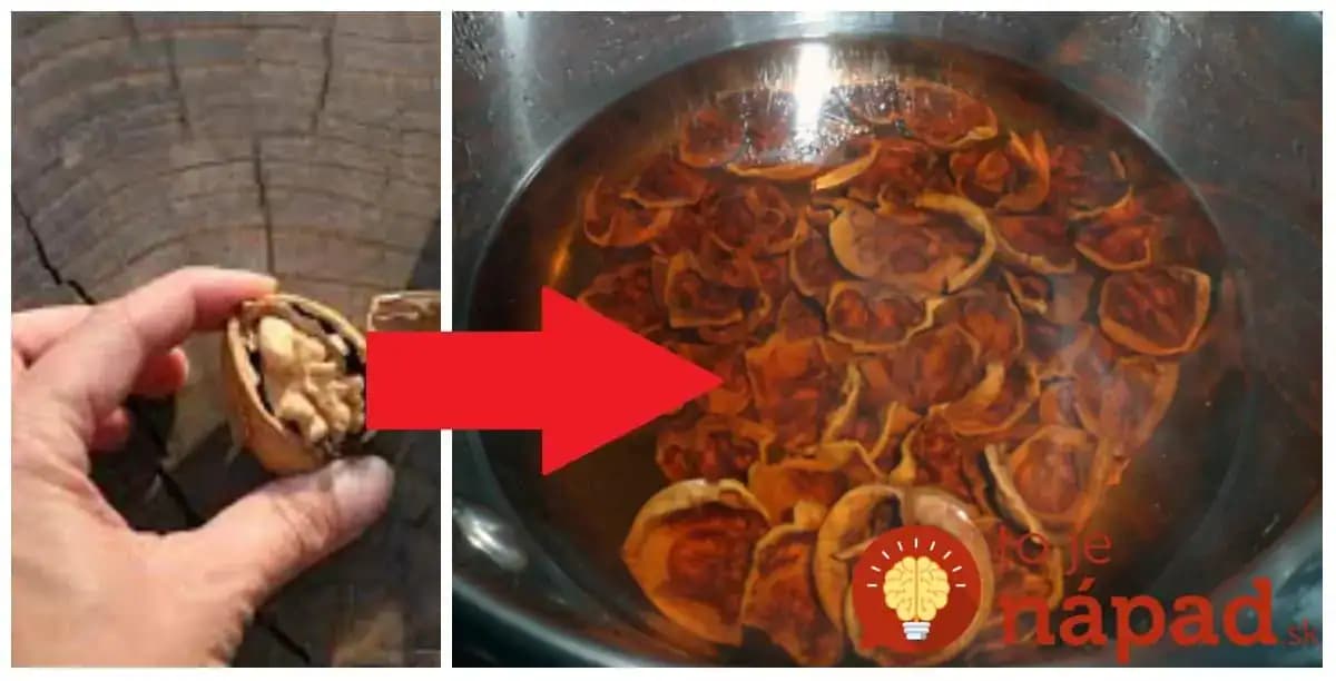 Čaj z orechových škrupín vám zmení život: Úžasné účinky, ktoré by mal poznať úplne každý!